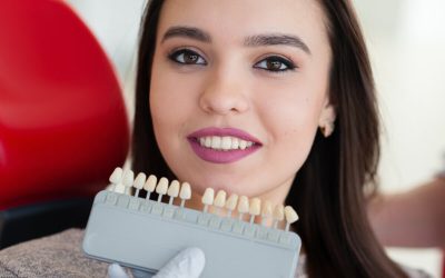 Do Veneers Protect Your Teeth? Answering the Most Common Dental Questions