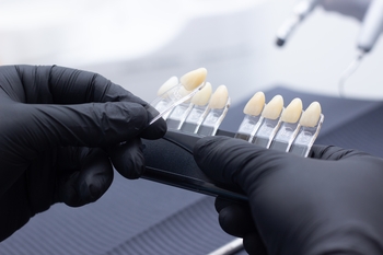 Veneers Cost Per Tooth — What You Need To Know