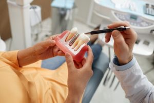 cheap dental implant materials pennant hills