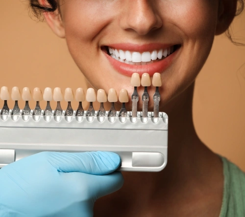 WHAT ARE DENTAL VENEERS IN PENNANT HILLS