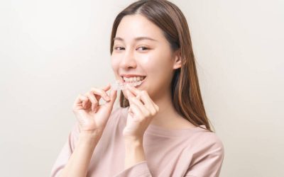 Understanding How Much Does Invisalign Cost for Your Smile