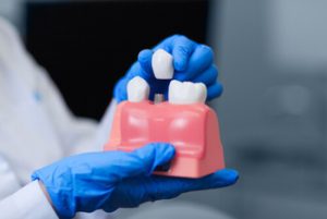50 Soft Foods to Eat After Tooth Extraction immediately