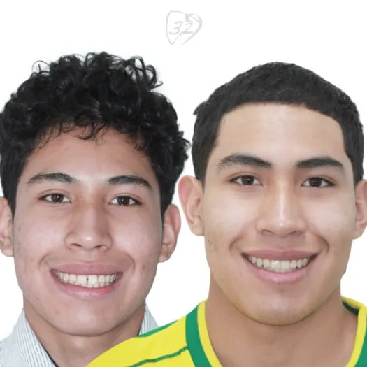 Beyond 32 Dental Before and after case 3 - David Mendoza
