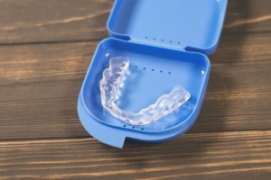 overbite treatments clear aligners