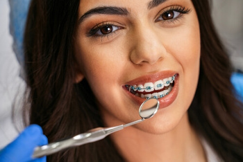 Do You Have to Wear Retainers Forever After Braces brackets