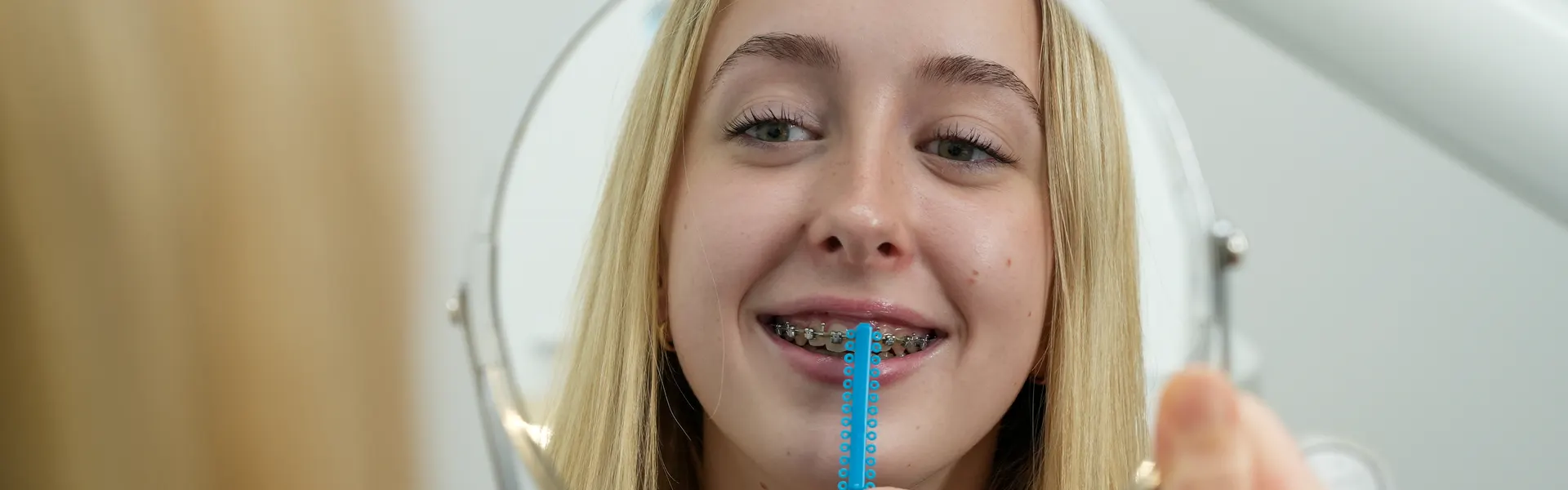 Damon Braces