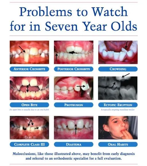 Problems to watch