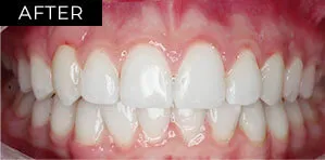 After Image