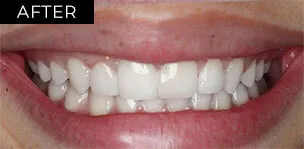 After Image