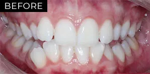 Before Image