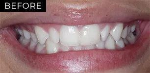 Before Image