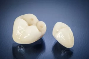 two samples of dental crowns