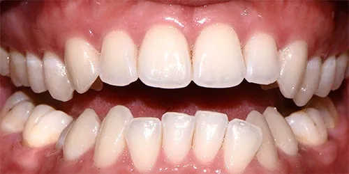 before Image