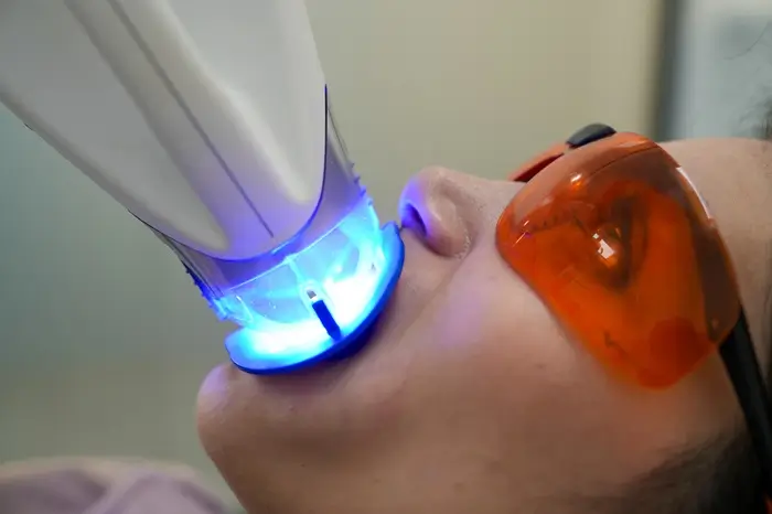 Professional Teeth Whitening in Pennant Hills