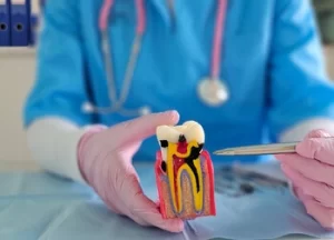 Home Remedy for Broken Tooth With Exposed Nerve decay